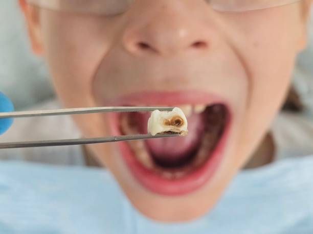 Best Urgent Dental Care for Toothaches in Montgomery, GA